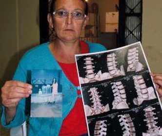 Lesionada pelo ritmo de trabalho, funcionária “bicampeã” brasileira é abandonada pela Seara/Marfrig 